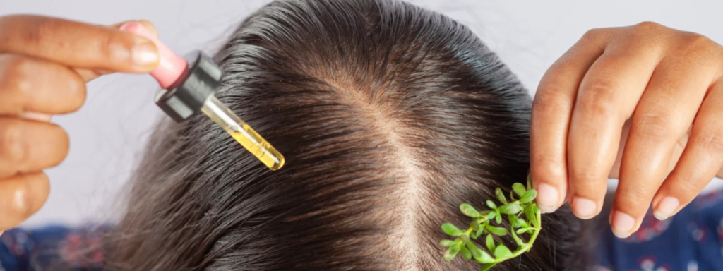 Hair Fall